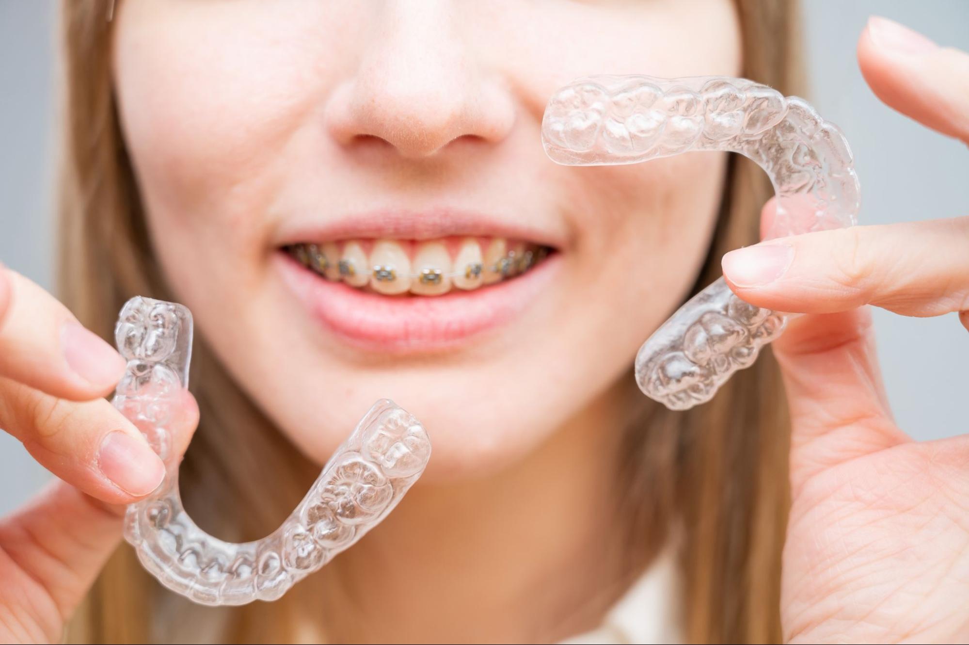Braces vs Invisalign with Austin orthodontics.